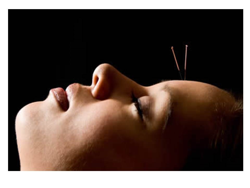 acupuncture treatment nuffield wolverhampton