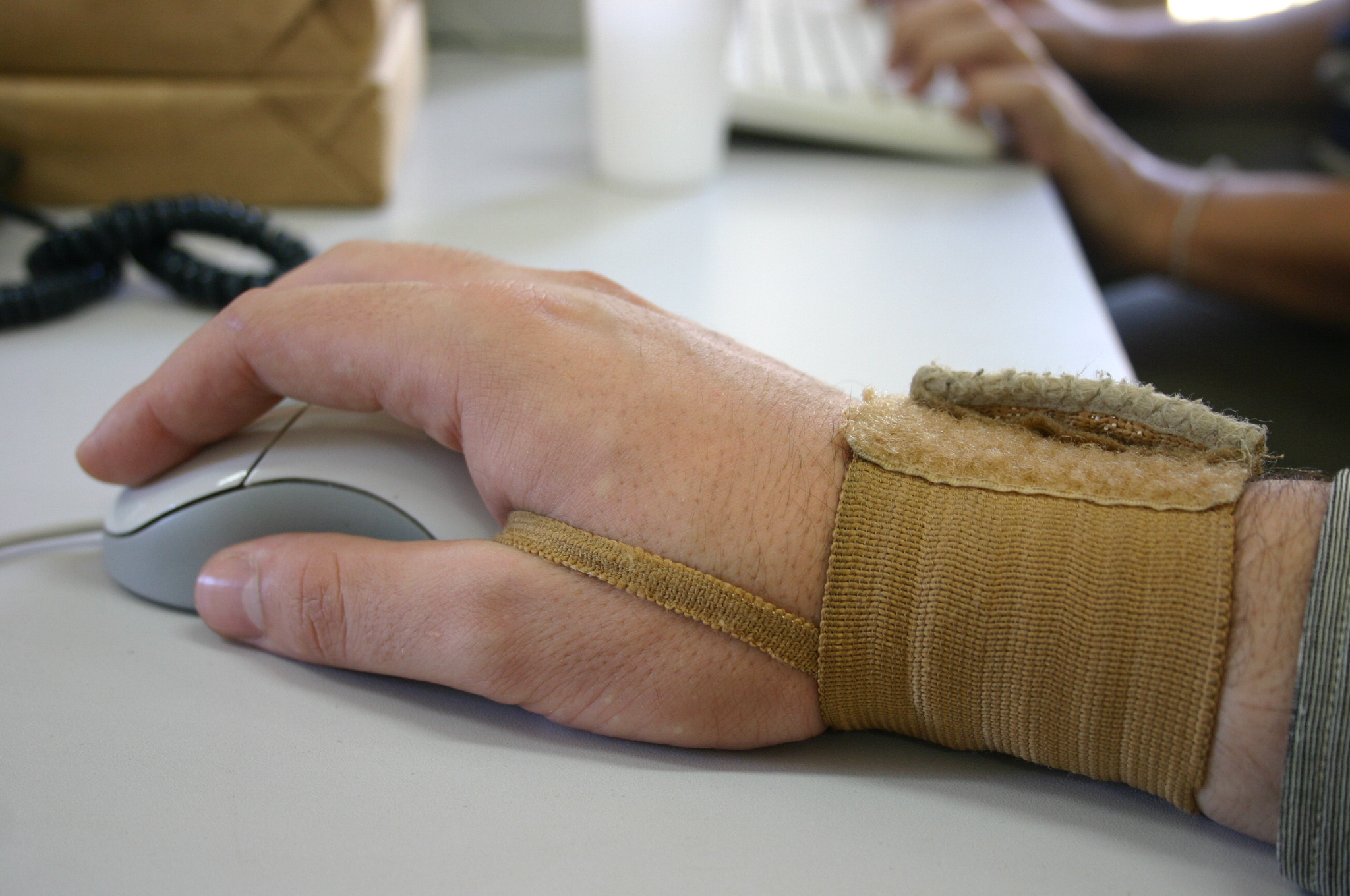 Carpal Tunnel Syndrome treatment nuffield wolverhampton