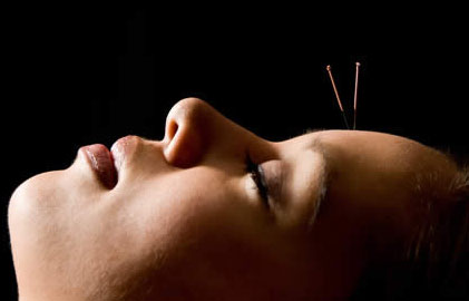 acupuncture for hay fever
