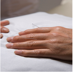 acupuncture treatment for weight loss