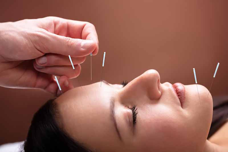 woman health treatment in acupuncture